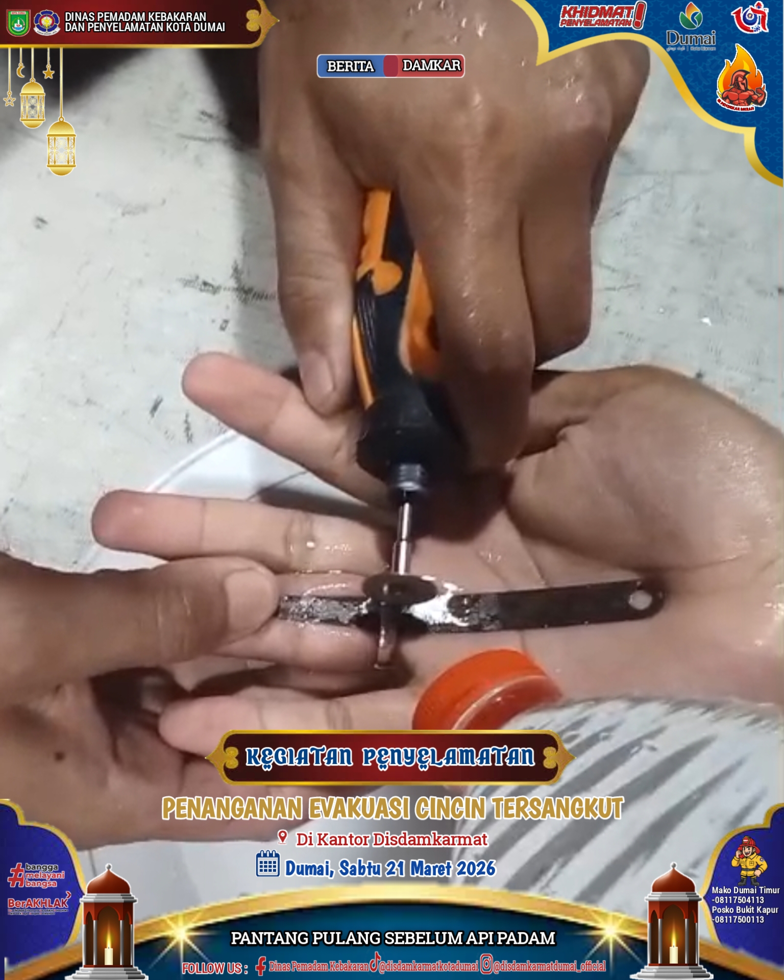 Evakuasi Cincin Tersangkut