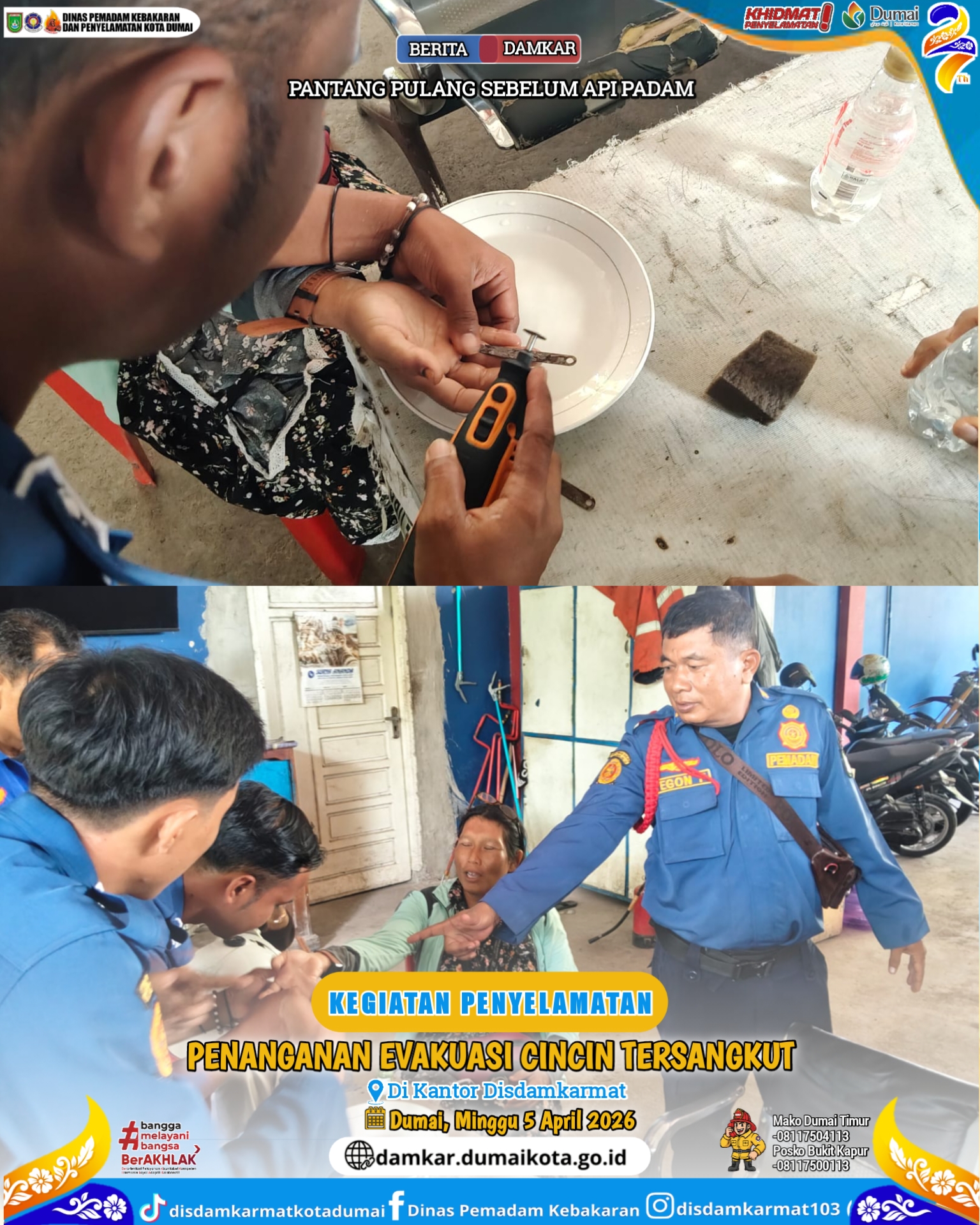 Evakuasi Cincin Tersangkut