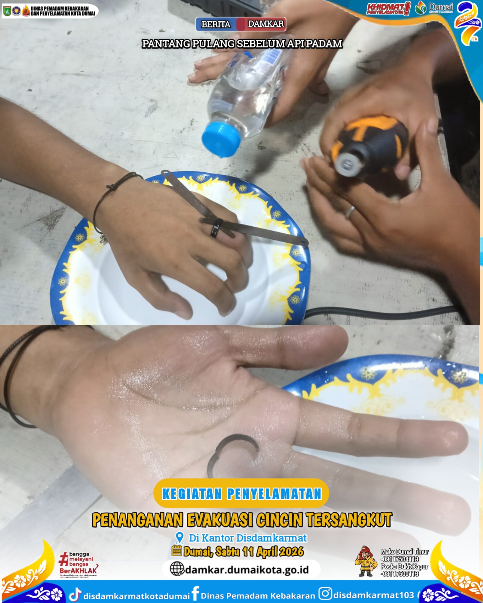 Evakuasi Cincin Tersangkut