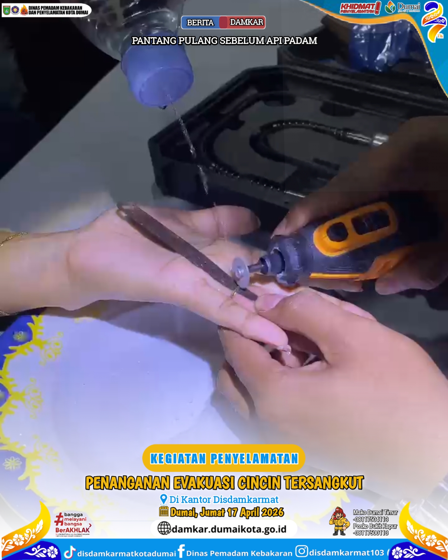 Evakuasi Cincin Tersangkut