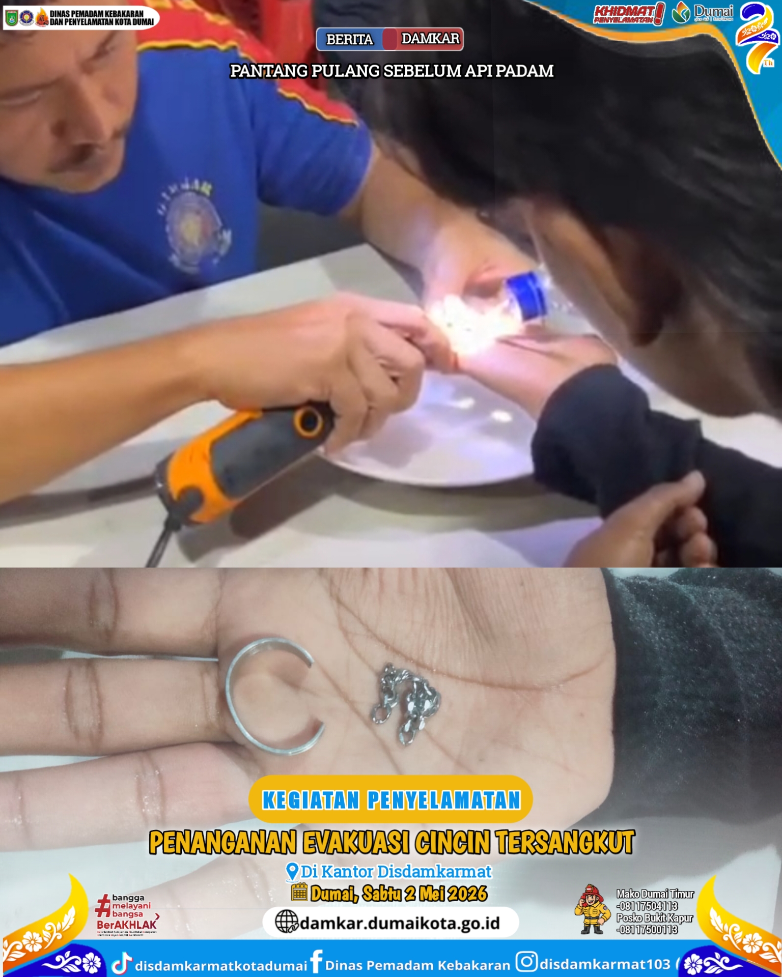 Evakuasi Cincin Tersangkut
