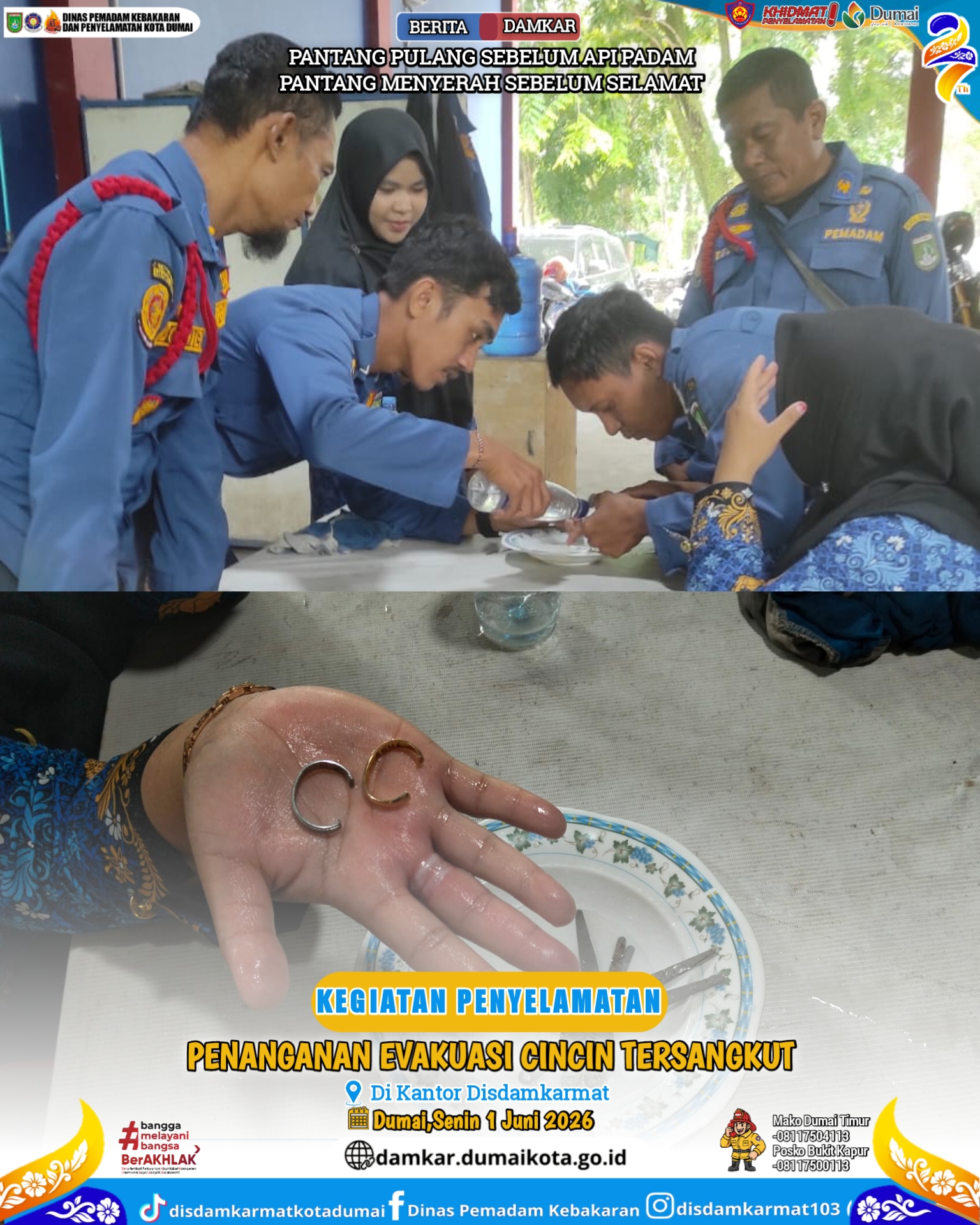 Evakuasi Cincin Tersangkut