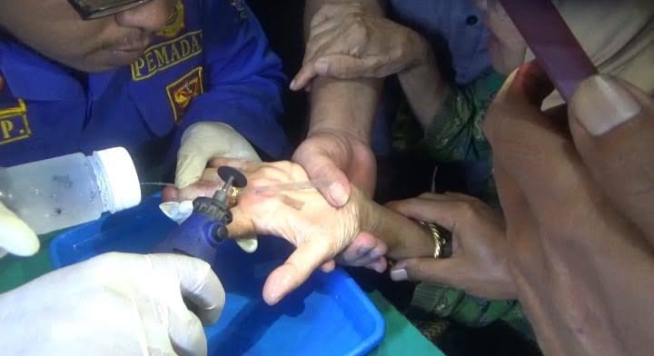 Cincin yg terjebak di Jari